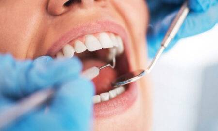 13 lucruri pe care dentiștii nu le pun niciodată în gură și sfătuiesc ca nici voi să nu o mai faceți