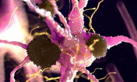 Studiul făcut pe mai multe imagini cu materia cerebrală sugerează că Parkinson ar putea fi de fapt două boli într-una