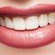 6 sfaturi sănătoase de albire a dinților