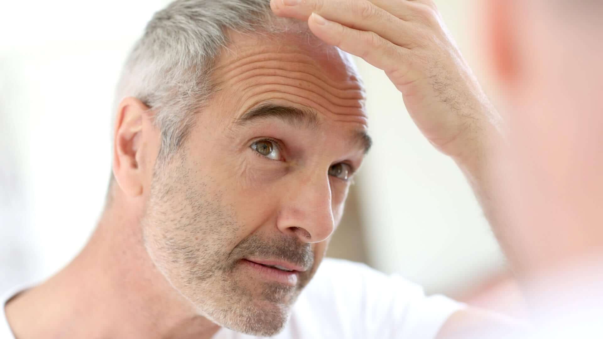 10 moduri de a opri căderea părului la bărbați