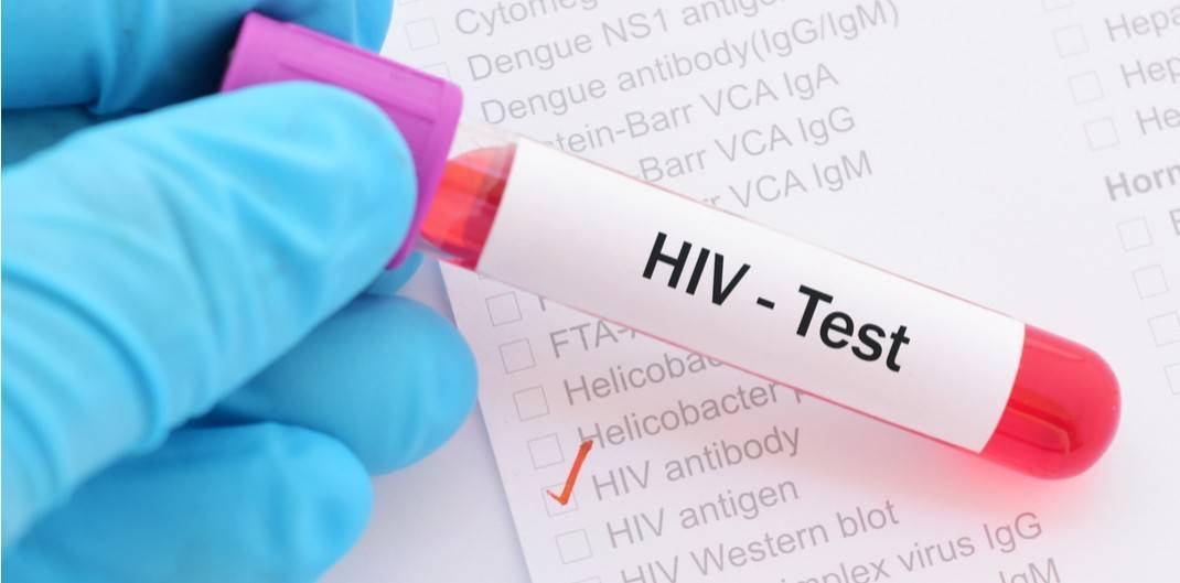 Oamenii de știință se apropie de combaterea HIV. Au identificat pașii critici în infecție
