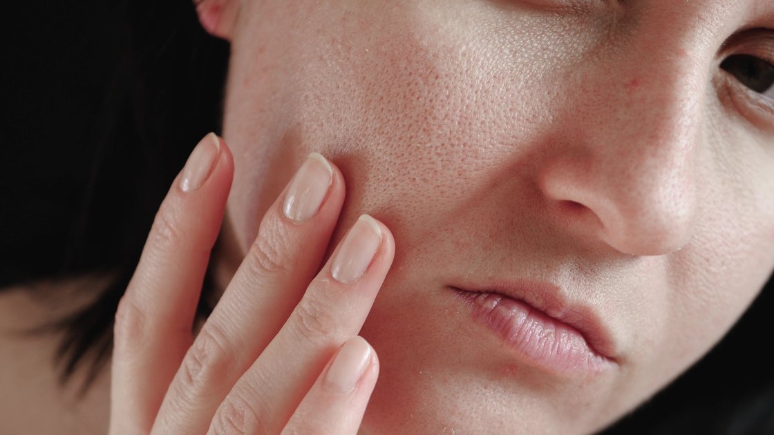 Top 5 sfaturi utile pentru îngrijirea pielii si a tenul uscat