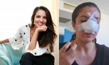 Cristina Joia a avut parte de o nouă operație estetică pentru repararea nasului. Cum se simte femeia acum?