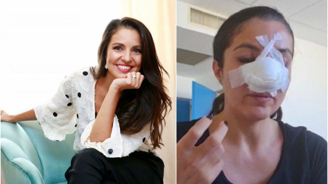 Cristina Joia a avut parte de o nouă operație estetică pentru repararea nasului. Cum se simte femeia acum?
