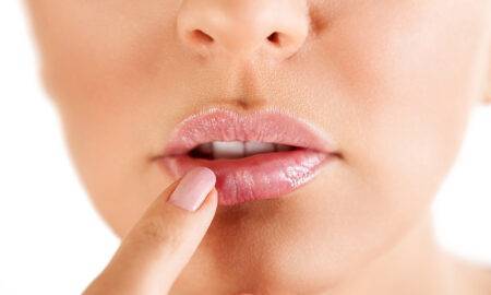 Ce este un herpes bucal și cum se poate trata? Iată ce spun specialiștii!