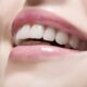 Tot ce trebuie să știi despre albirea dinților și care sunt cele mai eficiente variante pentru tine