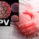 Alarmă mondială! 1 din 3 bărbați este infectat cu virusul HPV – Cât de periculos este?