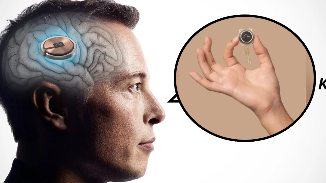 Neuralink, tehnologia revoluţionară care poate vindeca orbirea şi paralizia