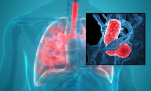 Alertă în România! Pneumonia ucide mii de români an de an, inclusiv copii – Simptomele sunt confundate cu alte boli